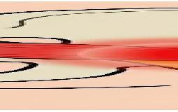 お尻の痛みや痺れ…